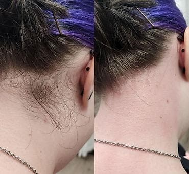 пилинг для мужчин: Восковая депиляция для женщин и мужчин Подмышки - 500 сом — 6