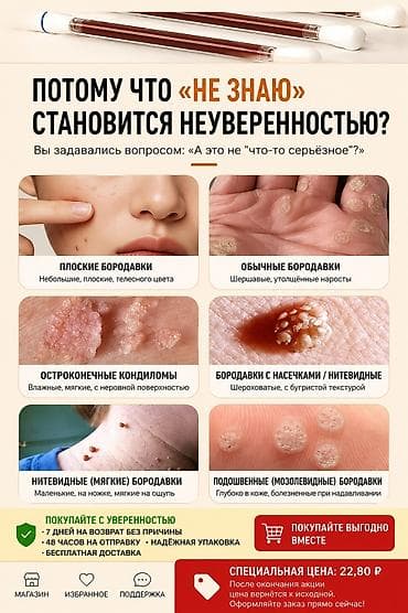 dr ceuracle: Средство для ухода за бородавками Wart Care Box, 4 мл. Что это: - — 1
