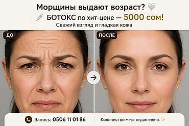 Косметология, Ботокс, Консультация, Гипоаллергенные материалы, Сертифицированный косметолог at lalafo.kg Косметология, Ботокс, Консультация, Гипоаллергенные материалы, Сертифицированный косметолог