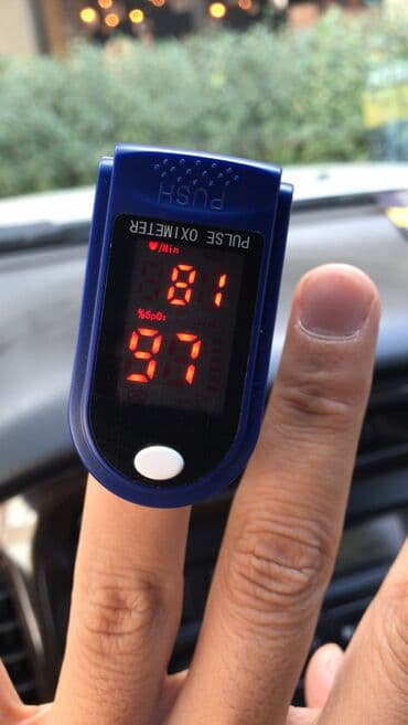 пульсоксиметр сколько стоит: Новый пульсоксиметр AB 88, не ширпотреб. Имеются европейский и — 4