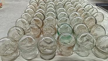 ортез для рук: Банки медицинские советские . массажные цена за одну банку — 2