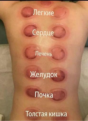 Массаж: Массаж — 10