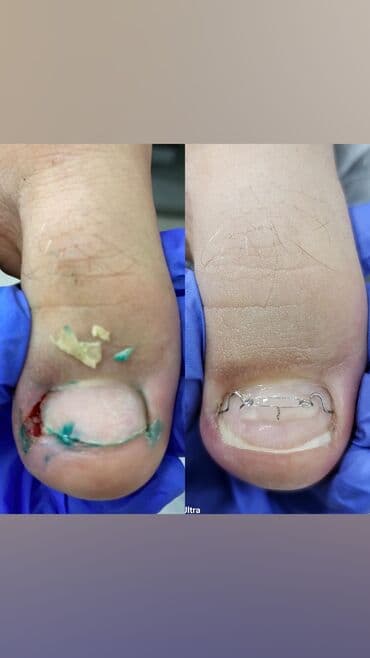 самый лучший эндокринолог рядом просп жибек жолу бишкек: Коррекция вросших ногтей, Услуги подолога, Маникюр, Педикюр, Одноразовые расходные материалы, Консультация — 1