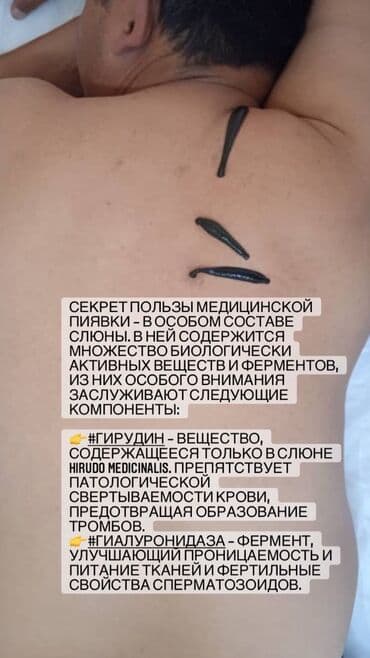 самый лучший гинеколог в бишкеке: Клиника, Дарыгерлер | Гирудотерапевт | Консультация, Диагностика, Пиявкалар менен дарылоо — 6