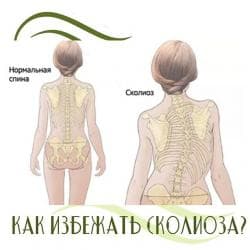 Кычкылтек жаздыктары: Корсеты, корректоры осанки, пояса для спины, реклинаторы 9-11 — 1