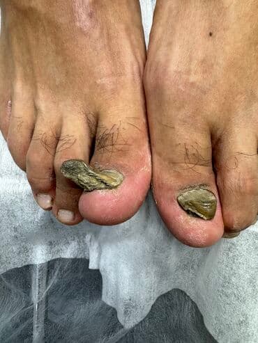 самый лучший эндокринолог рядом просп жибек жолу бишкек: Наращивание ногтей, Укрепление ногтей, Ремонт сломаных ногтей, Маникюр, Педикюр, С выездом на дом, Консультация, Одноразовые расходные материалы — 5