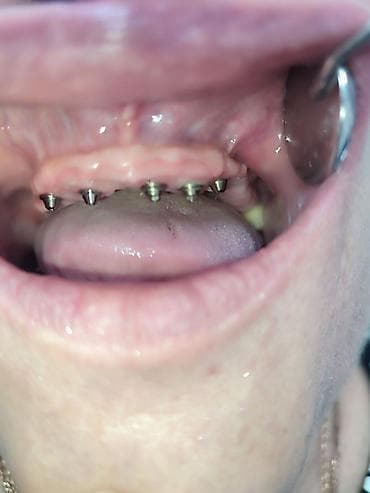 с чон таш: Врачи, Клиника | Стоматолог | Протезирование — 6