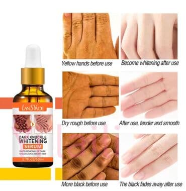 личный кабинет эрсаг кыргызстан: США Аmazon отбеливающая сыворотка отбеливающее масло для кожи — 14