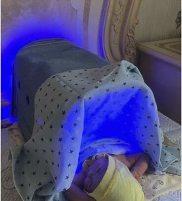 Медтовары: Фотолампа-кувез MAINENG для новорожденных. Результат за 5 дней — 3