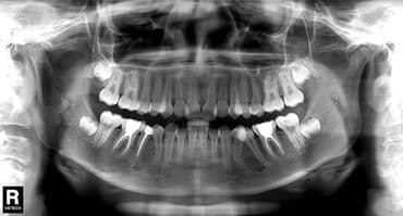 с достук: Продается Панорамный рентген 2д 2011 года vatech pax 400c всё работает — 2