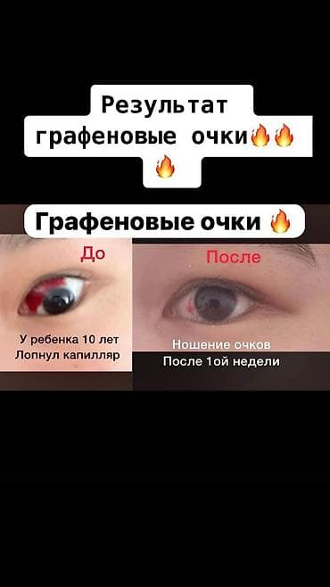 Другие медицинские товары