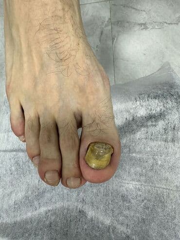 сколько стоит обучение на маникюр: Наращивание ногтей, Гель лак, шеллак, Укрепление ногтей, Услуги подолога, Маникюр, Педикюр, Консультация, Одноразовые расходные материалы — 5