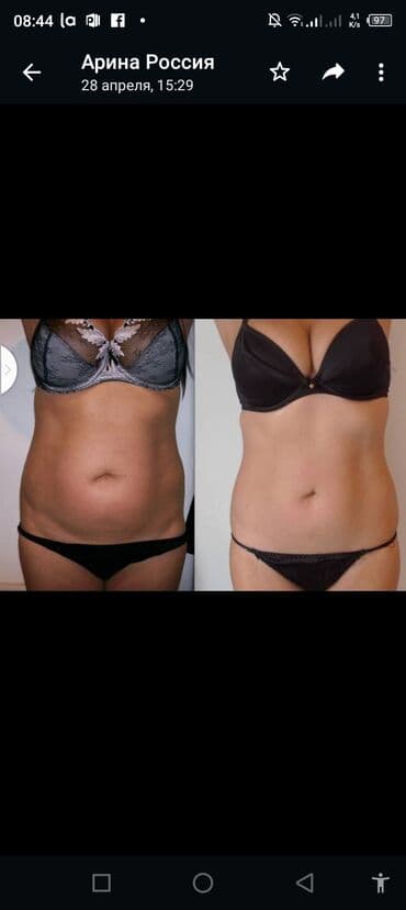 самый лучший эндокринолог рядом просп жибек жолу бишкек: Косметология, Ботокс, Восстановление объема губ, Лифтинг нити, С выездом на дом, Консультация, Гипоаллергенные материалы — 10