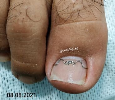 сколько стоит обучение на маникюр: Выравнивание, Наращивание ногтей, Донаращивание ногтей, Маникюр, Педикюр, Услуги подолога, Консультация, Одноразовые расходные материалы — 5