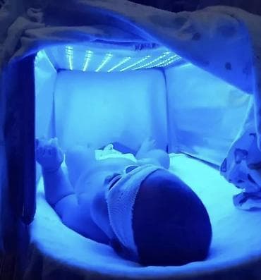 открытый: Фотолампа для новорождённых от желтушки (MAINENG) - Домашняя — 2