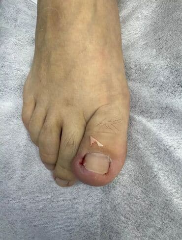 на дом керек: Услуги подолога, С выездом на дом, Консультация, Одноразовые расходные материалы — 9