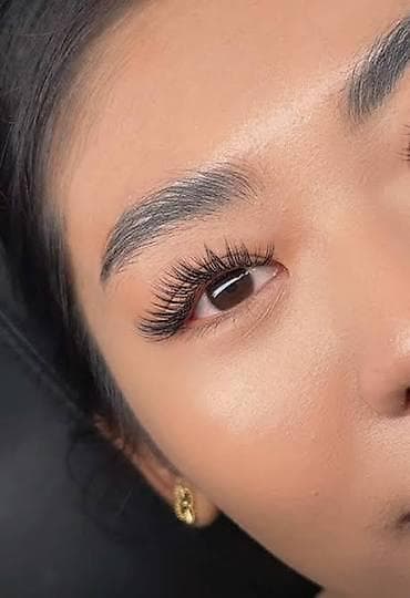 накладные брекеты для красоты: Лед наращивание. Стажер — 2