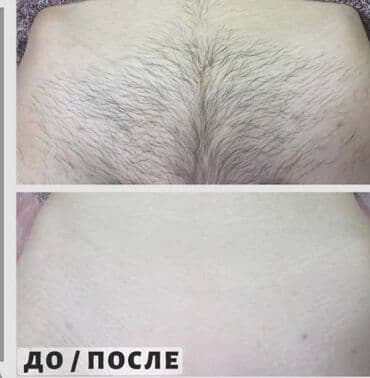 Женский шугаринг!!! Стерильность и профессионализм! предварительная