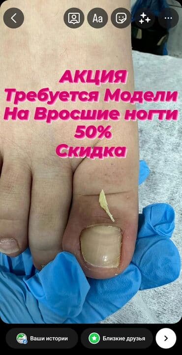 медсестра на дом бишкек мкр: Выравнивание, Наращивание ногтей, Донаращивание ногтей, Маникюр, Педикюр, Услуги подолога, С выездом на дом, Консультация, Одноразовые расходные материалы — 1