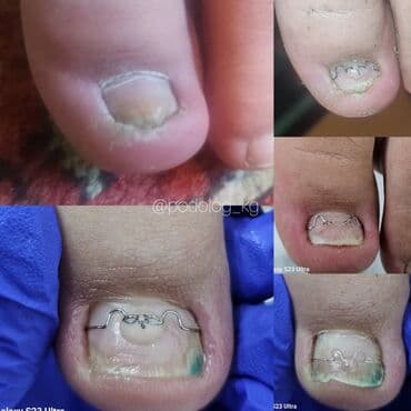 сколько стоит обучение на мастера маникюра: Выравнивание, Наращивание ногтей, Донаращивание ногтей, Маникюр, Педикюр, Услуги подолога, С выездом на дом, Консультация, Одноразовые расходные материалы — 2