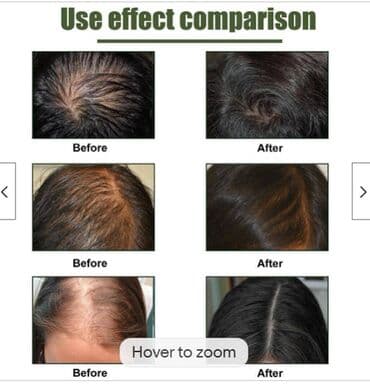 личный кабинет эрсаг кыргызстан: ❄️ С️ША Сыворотка для роста волос и бороды blusoms folligrow — 1