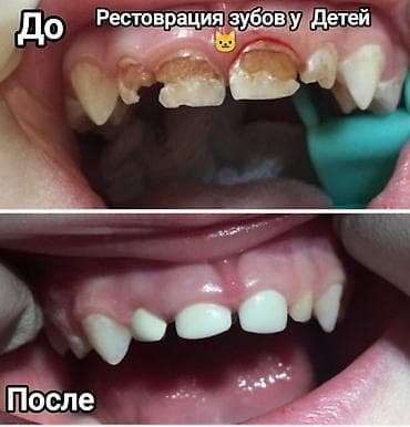 установка поровой: Клиника | Стоматолог | Диагностика — 7