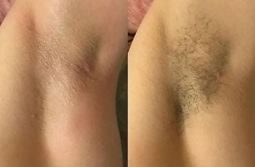 красилер: Акция!!! Бикини и подмышки всего за 500с Шугаринг — профессиональная — 5