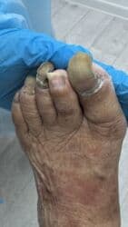 на дом керек: Услуги подолога, С выездом на дом, Консультация, Одноразовые расходные материалы — 17