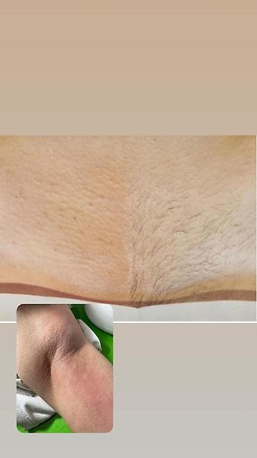 женская обувь сапоги: Шугаринг и восковая депиляция - Зоны: подмышки, руки, ноги, бикини и — 3