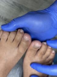 на дом керек: Услуги подолога, С выездом на дом, Консультация, Одноразовые расходные материалы — 14