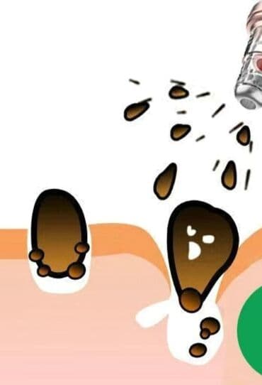 многоразовые маски бишкек: Саламатсызбы! Бул аппараттын эң өзгөчө максаты 👃 мурундагы кара точка — 3