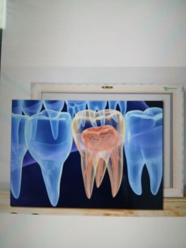картины настенные: Панно «Зубы» на стекле/акриле - Яркое медицинское изображение зубов в — 1