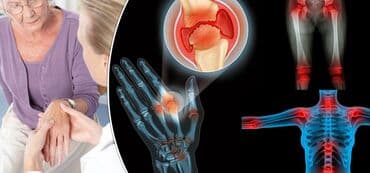 эко спрей от вшей как пользоваться: Бишофит от чего помогает. опорно-двигательного аппарата — 2