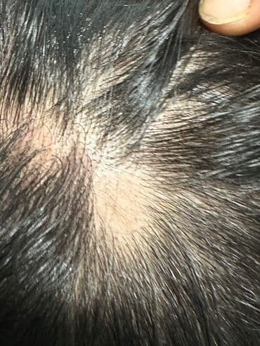 медсестра на дом бишкек мкр: Врачи | Дерматолог | Диагностика, Консультация — 3