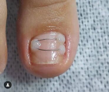 сколько стоит обучение на мастера маникюра: Выравнивание, Наращивание ногтей, Донаращивание ногтей, Маникюр, Педикюр, Услуги подолога, Консультация — 13