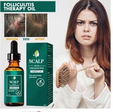 шампунь дисаар: ❄️ США От выпадения волос от облысения от алоп еции для густоты волос — 25