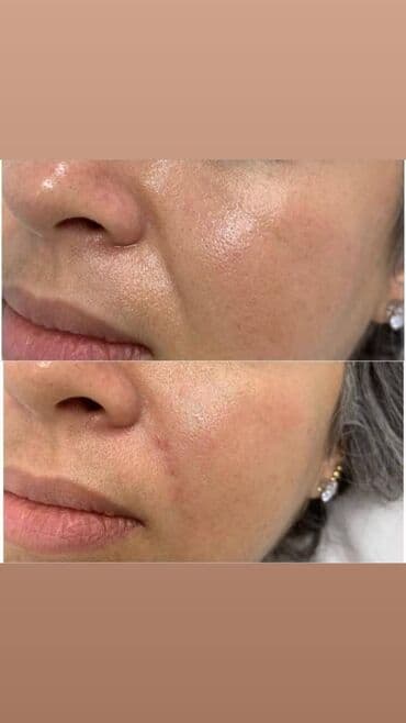 самый лучший эндокринолог рядом просп жибек жолу бишкек: Косметология, Ботокс, Биоревитализация, Ботулинотерапия, Консультация, Гипоаллергенные материалы, Сертифицированный косметолог — 8