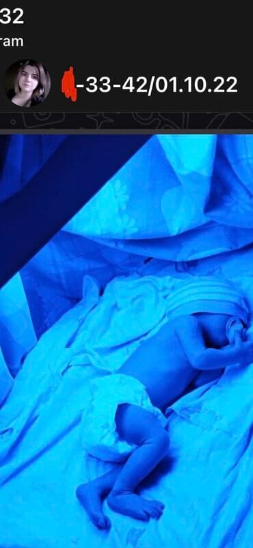 Кычкылтек концентратору: Аренда фотолампы от желтушки для новорожденных. 💛 Почему выбирают — 1