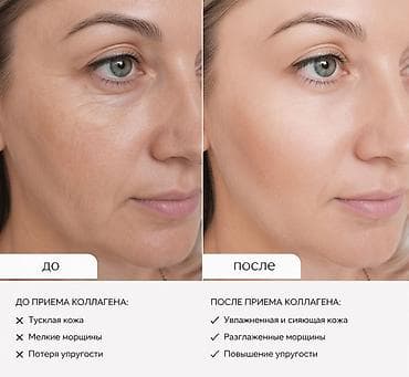 сертификаты атоми: Замечаете, что кожа теряет упругость, появляются морщины и уже не тот — 2