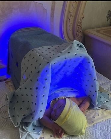 Мед. товарлар: ФОТОЛАМПА ОТ ЖЕЛТУХИ ДЛЯ НОВОРОЖДЕННЫХ — АРЕНДА! 👶✨ Не нужно — 7