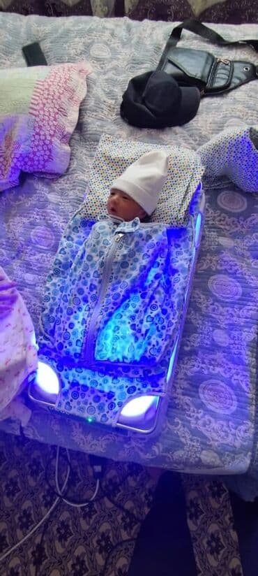 Бинттер, таңгычтар: Фотолампа для лечения желтушки новорожденных в аренду (лампа нижнего — 5