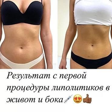 липолитик: Все косметологические процедуры, лечение угревой болезни, #нитевой — 10