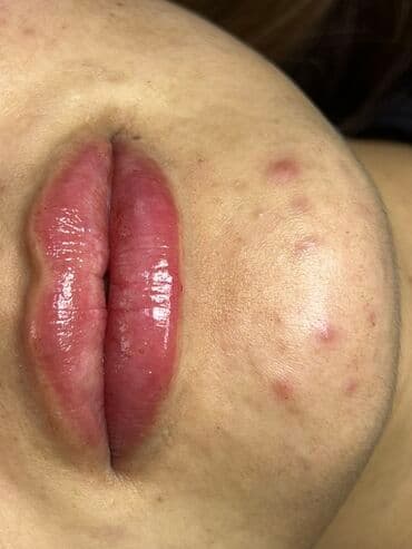 самый лучший эндокринолог рядом просп жибек жолу бишкек: Косметология, Маски, Мезотерапия, Удаление носогубных складок, Гипоаллергенные материалы, Консультация, Сертифицированный косметолог — 3