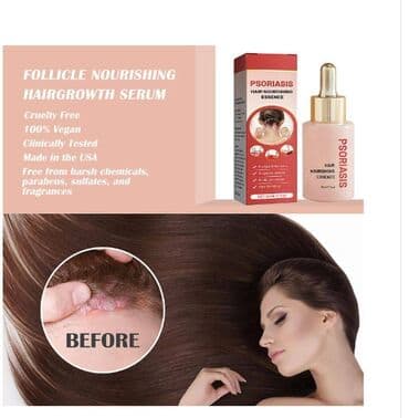 Киреге берилүүчү кийимдер: ❄️ США псориаз головы средство с валмарта питательная эссенция для — 7