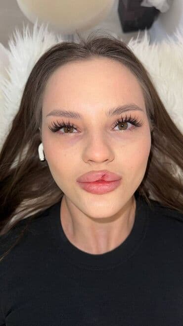 узи с выездом на дом бишкек: Ресницы, Консультация — 5