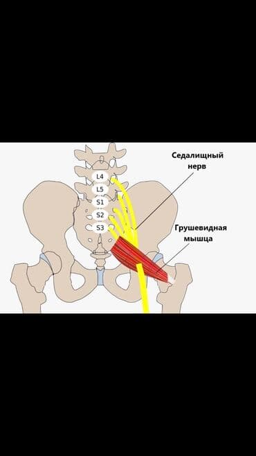 массаж швз: Массаж | Остеохондроз, Межпозвоночная грыжа, Протрузия | С выездом на дом, Консультация — 12