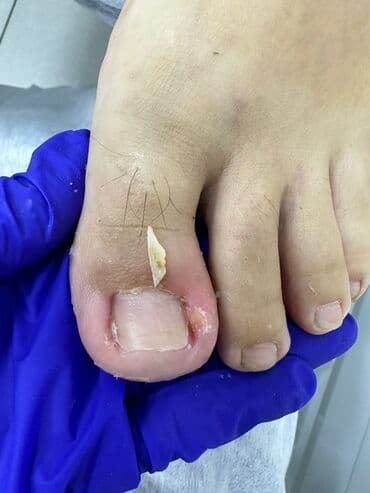 сколько стоит обучение на мастера маникюра: Коррекция вросших ногтей, Маникюр, Педикюр, Услуги подолога, Консультация, Одноразовые расходные материалы — 7