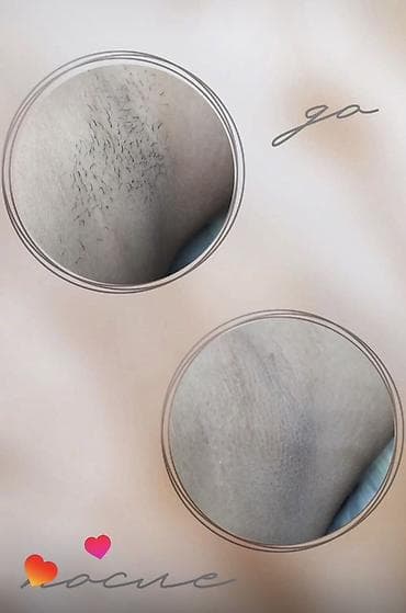 массаж только для мужчин: Мужская и женская депиляция Мужская депиляция ‼️только депиляция — 4