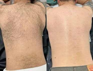 Г.Ош,Шугаринг на все зоны для мужчин!Избавьтесь от лишних и