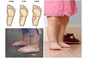 Стельки ортопедические(специализированные) от плоскостопия! Для